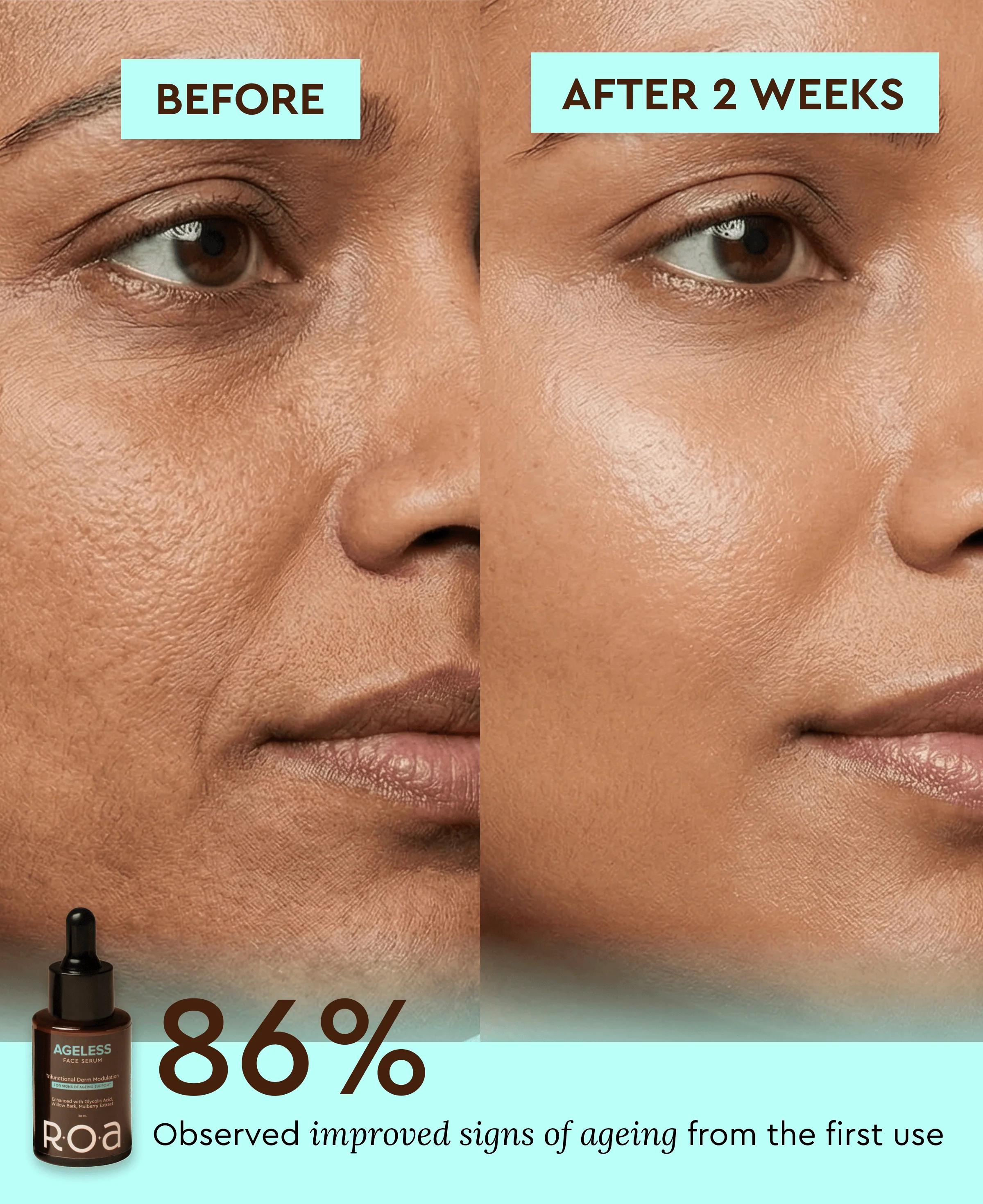 AGELESS - AHA BHA DUAL ACTION FACE SERUM - Image 8