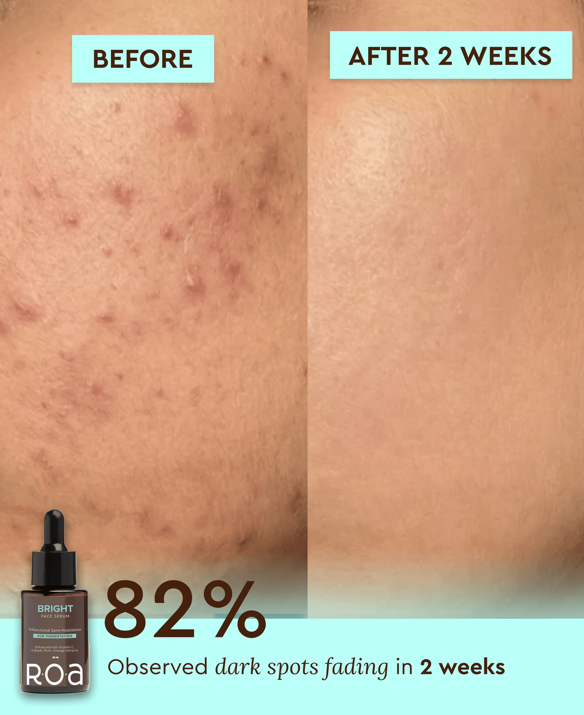 BRIGHT – 10% VITAMIN C FACE SERUM - Image 3