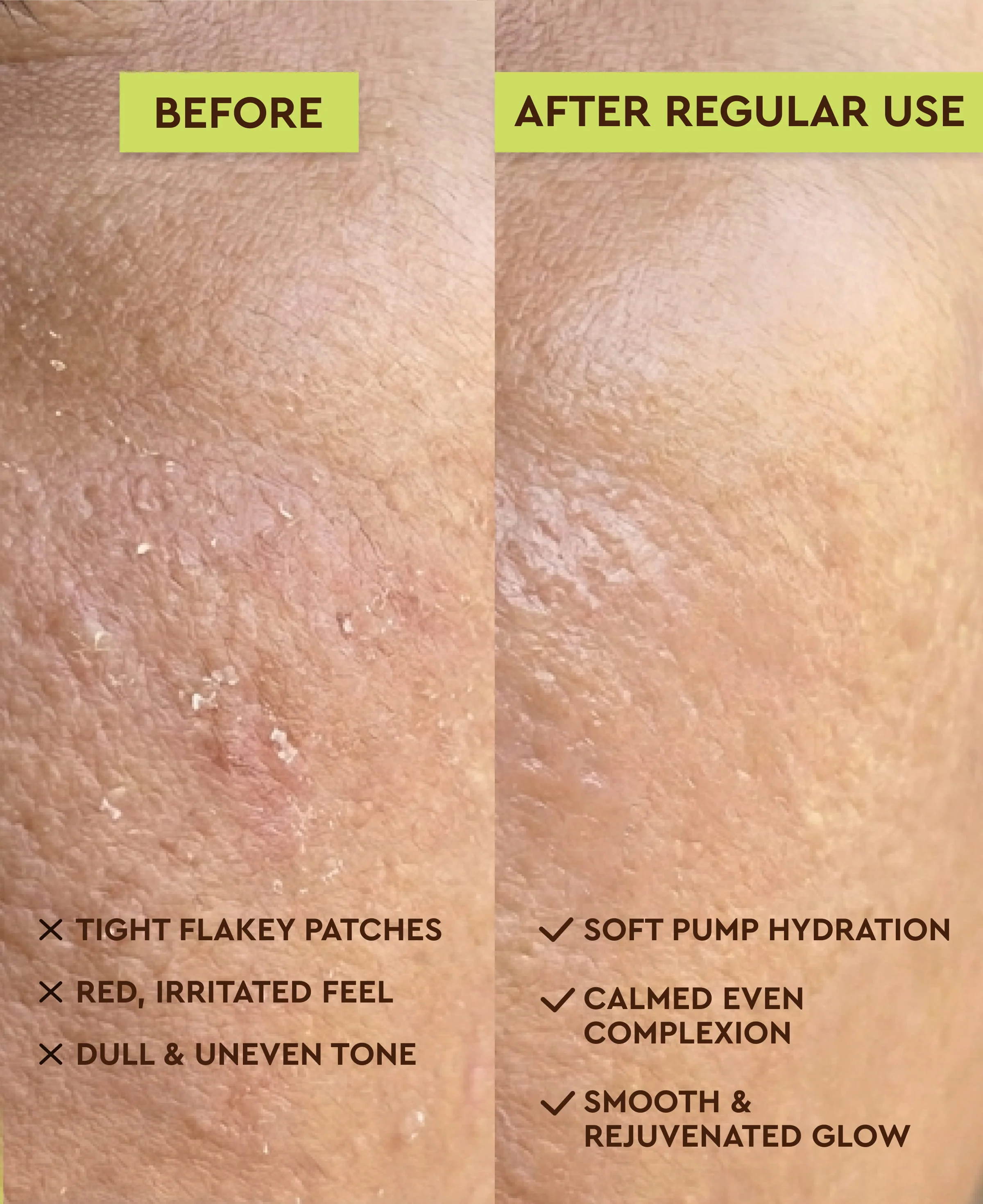 ROA SKINCARE AQUA CENTELLA CLEANSER FOR DRY OR SENSITIVE SKIN - Image 4